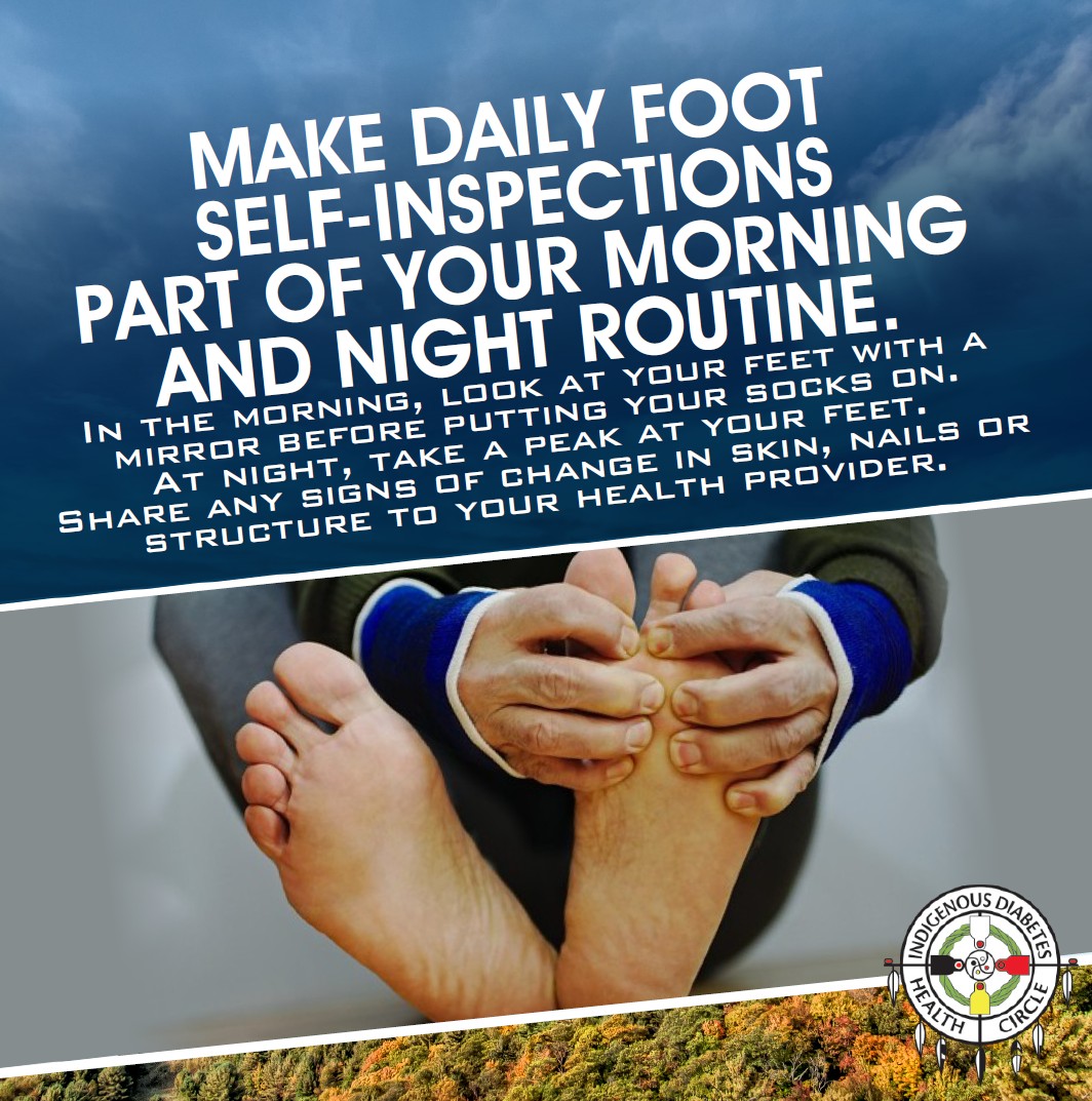 MAKE DAILY FOOT SELF-INSPECTIONS PART OF YOUR MORNING AND NIGHT ROUTINE ...